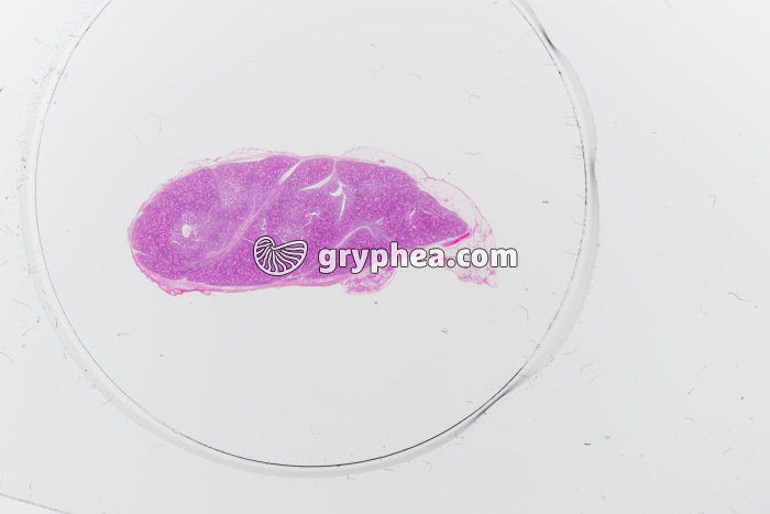 ParathyroÏde x1,5 - gryphea.com